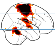 /img/combining-nilearn-plots/fig2.png